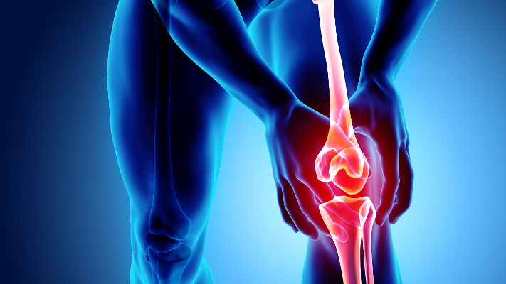 التغذية الصحيحة لمرض التهاب المفاصل التنكسي