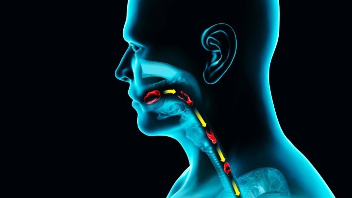 عسر بلع الطعام هل يمكن أن يؤدي إلى الإصابة بمرض قاتل؟