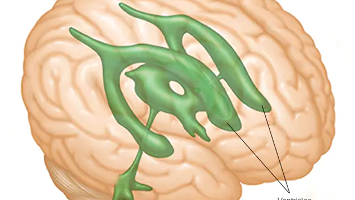بماذا يختلف الاستسقاء الدماغي عند الكبار عن الصغار ؟