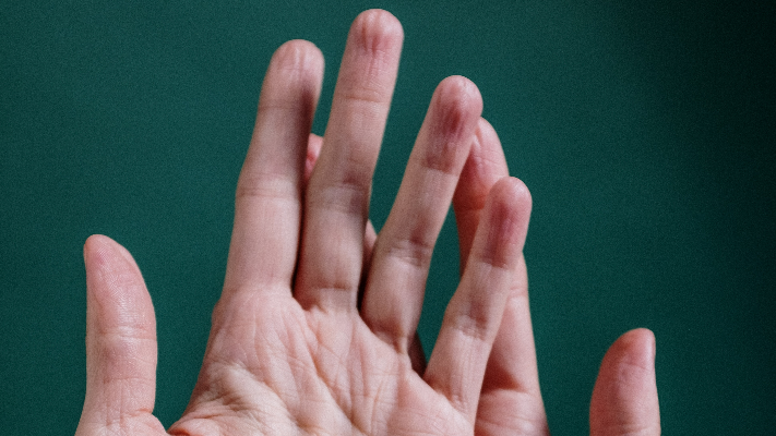 كيف تحمي جلدك من الفطريات والتسلخات في الصيف؟