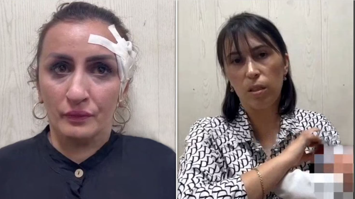 أم روسية تبيع طفلتها الرضيعة من أجل عملية تجميل