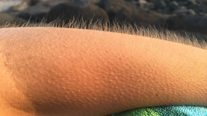 هل التحكم في القشعريرة ممكن؟