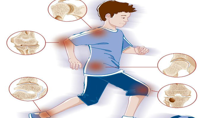التهاب المفاصل لدى الأطفال .. كيف يؤثر على حياتهم؟ - فيديو