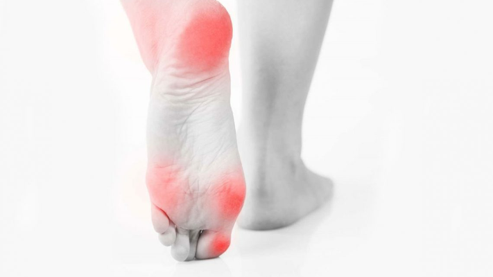 ما هو اعتلال العصب السكري وما هي أعراضه؟ - فيديو