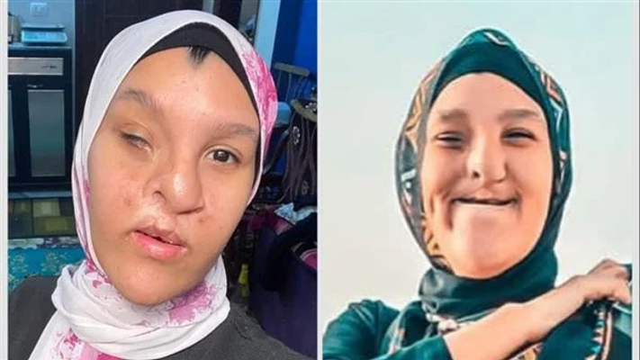 اليوتيوبر إسراء أحمد "أم روح حلوة"  تنشر أول صور لها بعد إجراء عملية تجميلية لـ شكلها