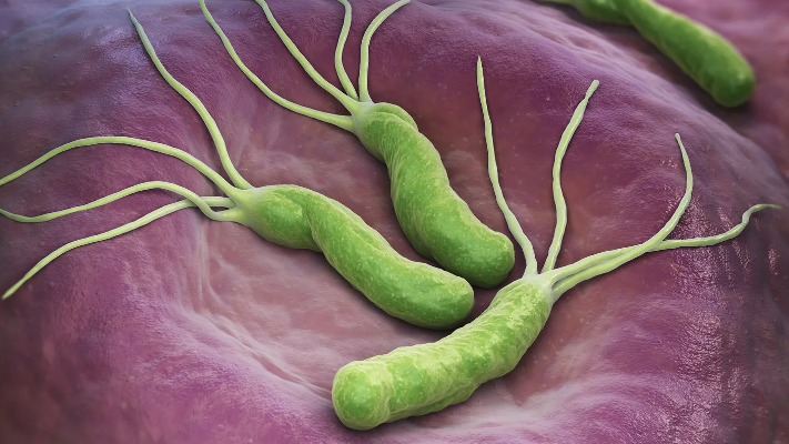 متى يجب اللجوء لتشخيص الجرثومة الحلزونية وعلاجها؟