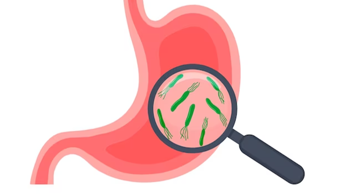 كيف تعرف أنّك مصاب بجرثومة المعدة؟