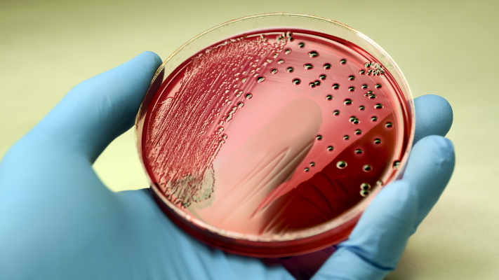 الباحثون قلقون .. العثور على بكتيريا ماصّة للدماء!