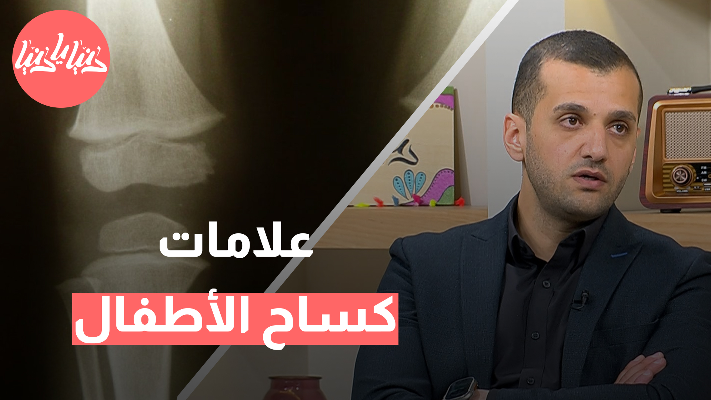 كيف تميزين أعراض كساح الأطفال وتتخذين الخطوات الفورية؟ - فيديو