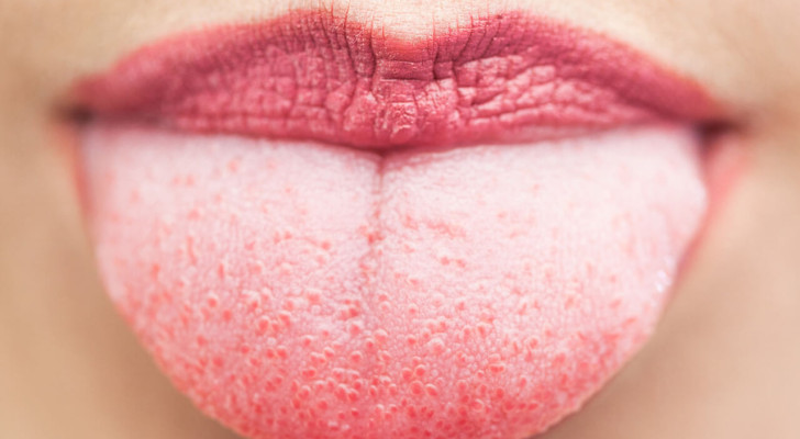 ماذا يعني تغير لون اللسان؟