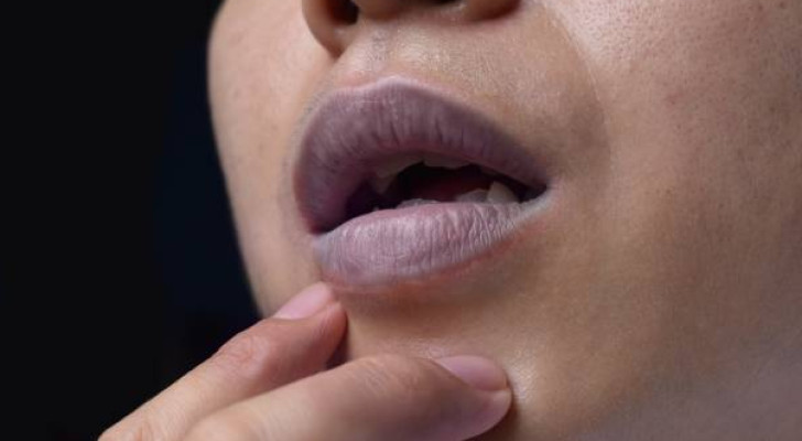 ما أسباب ميل لون الشفاه إلى الأزرق؟