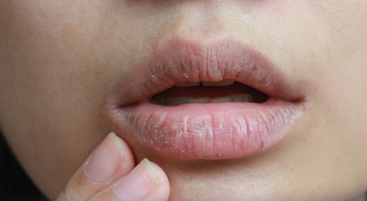 جفاف الفم .. قد يكون علامة على مرض خطير!