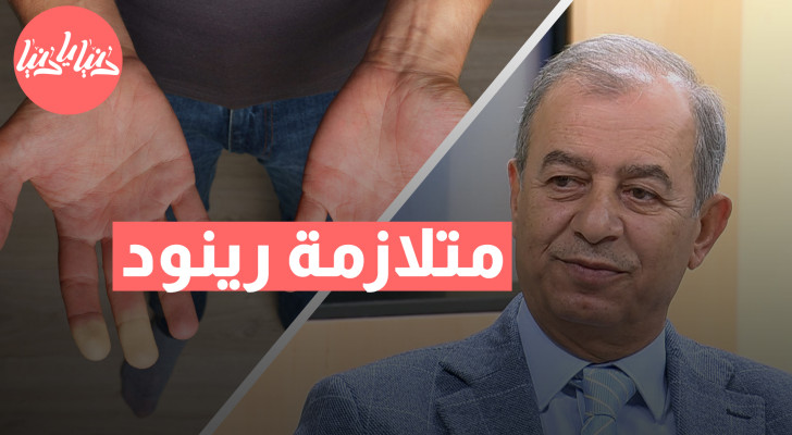 ما هي أسباب متلازمة رينود وأفضل العلاجات - فيديو