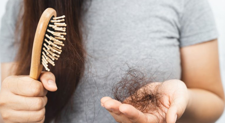 إدمان الوجبات السريعة أفقدها شعرها بالكامل.. قصة صادمة!