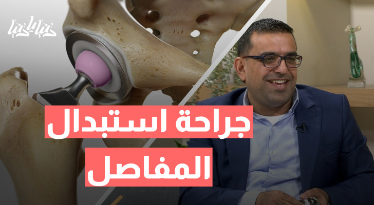 المفاصل الصناعية: فوائدها، مخاطرها، ومتى تكون الخيار الأفضل؟ - فيديو