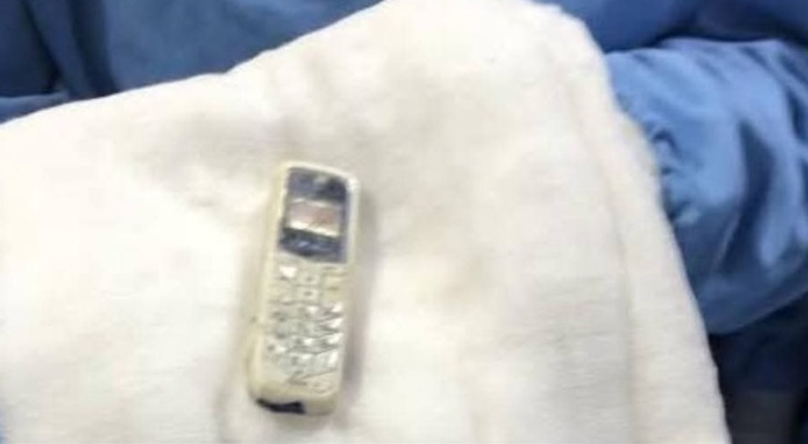 في دولة عربية .. استخراج هاتف محمول من معدة مريض ابتلعه قبل 6 سنوات!