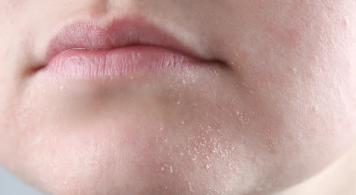 بسبب الصيام والطقس البارد .. كيف تتجنبين جفاف الفم وتشقق الجلد حوله؟