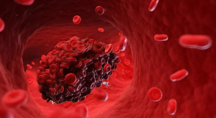 دراسة جديدة: الصيام يمنع مكونات جلطة الدم من التشكل