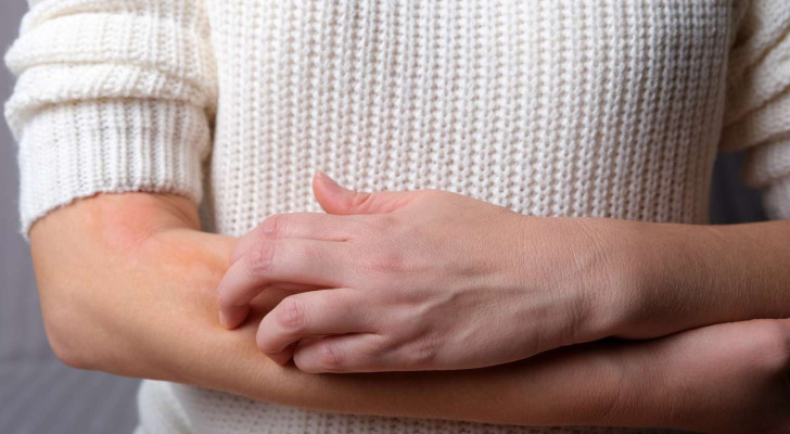 لا تتجاهل هذه الإشارات.. متى تكون حكة الجسم خطيرة؟