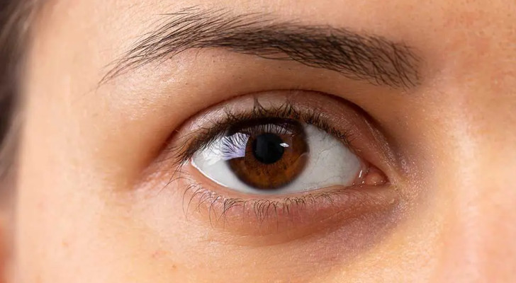 لا تتجاهل عينيك.. هذه العلامات قد تكشف عن وجود مرض في الكلى!