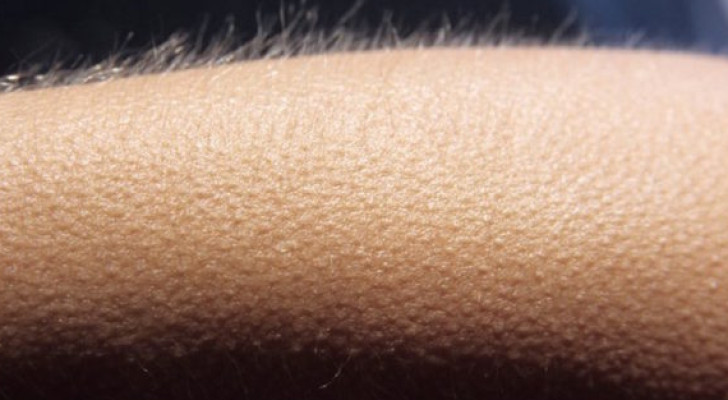 لماذا نشعر بالقشعريرة عند سماع أغنية معينة أو مشاهدة مشهد مؤثر؟