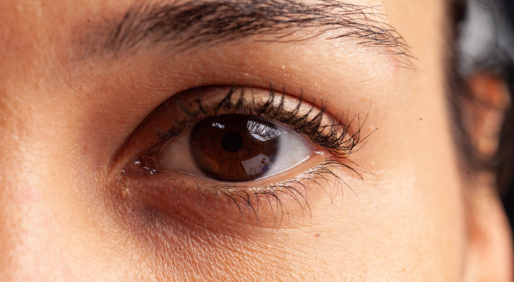 انتبه لعينك.. هذه العلامة قد تكشف ارتفاع الكوليسترول دون أن تدري!