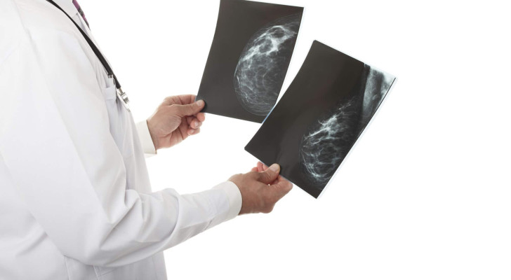 هل ارتداء حمالة الصدر الضيقة يسبب سرطان الثدي؟