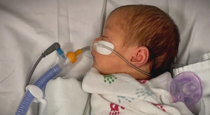 الفيروس التنفسي المخلوي RSV يعود: كيف يؤثر على الأطفال دون 6 أشهر؟