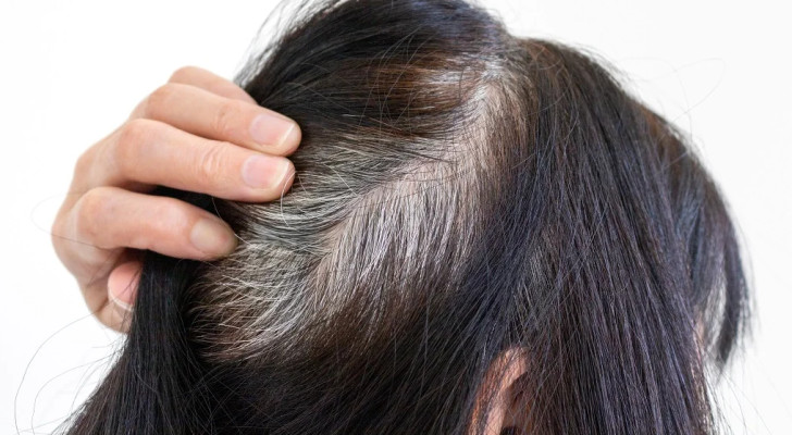 اكتشاف علمي سيغير نظرتك للشعر الرمادي .. الشيب يحميك من السرطان!