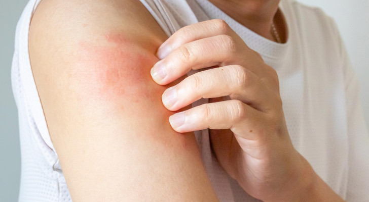 انتبه جيدًا .. علامات إذا ظهرت على جسمك فقد تشير لنقص فيتامين ج