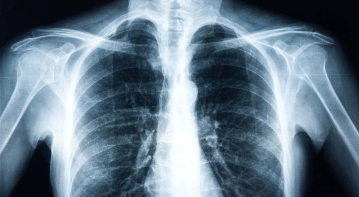 أول لقاح منذ 100 عام.. العلم يقترب من هزيمة أخطر مرض بالعالم!