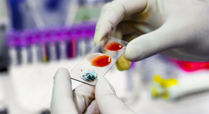 فصيلة دمك قد تكشف إذا كنت معرضة للإصابة بسرطانات الجهاز الهضمي!