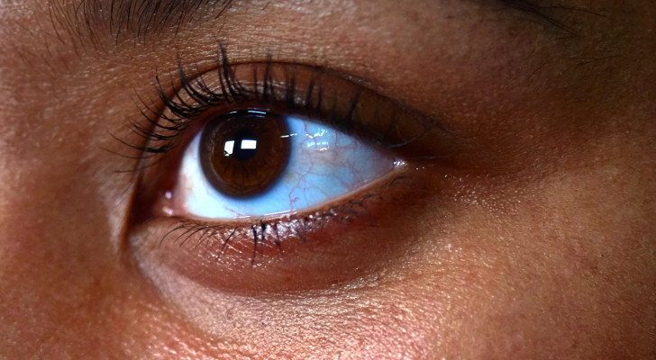 بدون مكياج ولا كونسيلر.. 3 حيل سحرية لإخفاء الهالات السوداء!