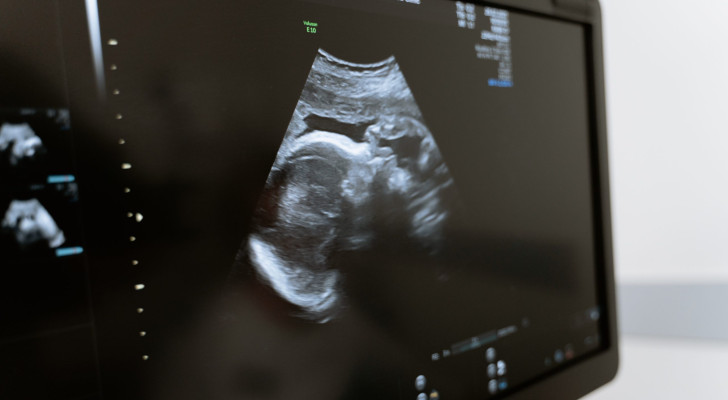 مصر: سيدة حامل بتسعة أجنة… حالة نادرة تذهل الأطباء!