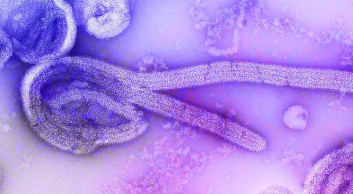 هل نحن مستعدون لفيروس قد يفتك بالبشر؟ بعد انتشاره في إثيوبيا تعرف على فيروس "ماربورغ"