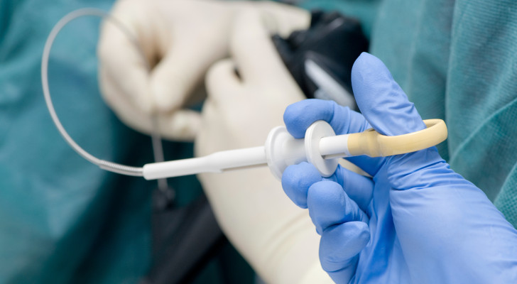 أعراض بطنية إذا ظهرت عليك فاعلم أنك بحاجة لإجراء تنظير هضمي