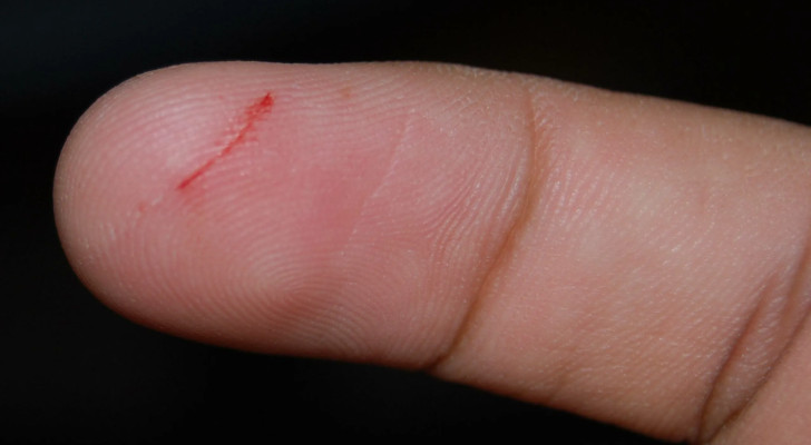 لماذا جرح الإصبع بالورقة مؤلم أكثر من باقي الجروح؟ لن تتوقع السبب!