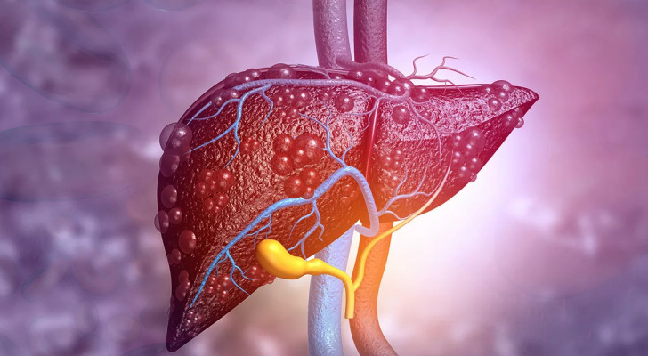 لمرضى الكبد الدهني: 7 أطعمة ممنوع أن تأكلها نيئة.. احذرها