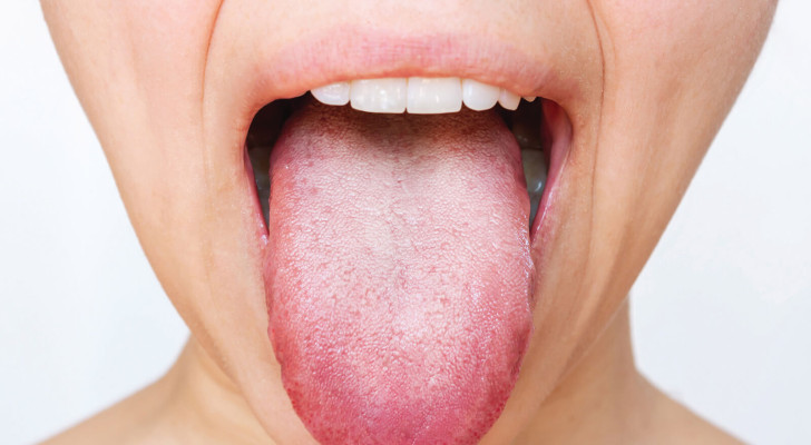 ما هي أعراض نقص فيتامين د على اللسان؟