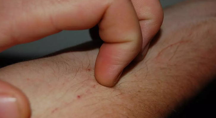 5 علامات تظهر على جسمك وتكشف انهيار كبدك بصمت!