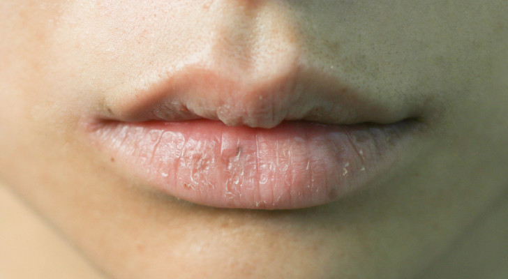 الشفاه الباهتة .. علامة تحذيرية خطيرة من جسمك.. لا تتجاهلها