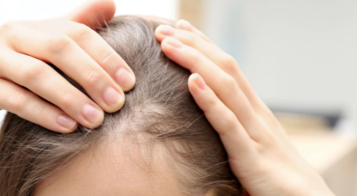 امرأة تعاني من تساقط شعر حاد بعد الولادة، ما التفسير الطبي؟