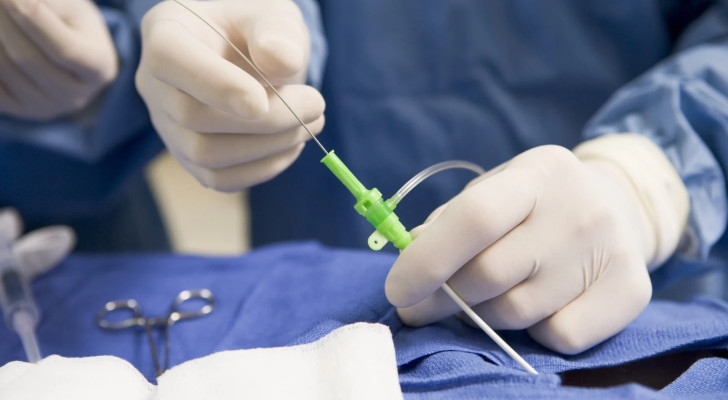 أعراض وعلامات على جسمك تدل أنك بحاجة لإجراء فحص القسطرة القلبية