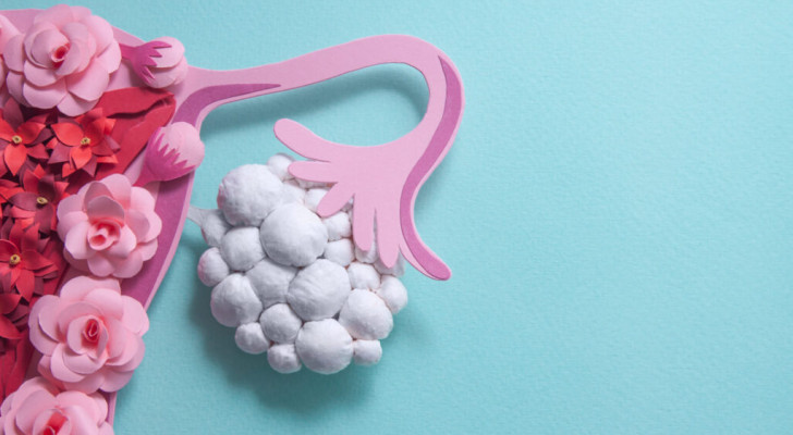 هل تعانين من هذه الأعراض؟ قد تكون مؤشرات لتكيس المبايض ومقاومة الإنسولين