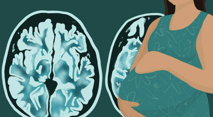 معلومة قد تصدمك! ما حقيقة انكماش دماغ المرأة أثناء الحمل وعودته بعد الولادة بـ 6 أشهر؟