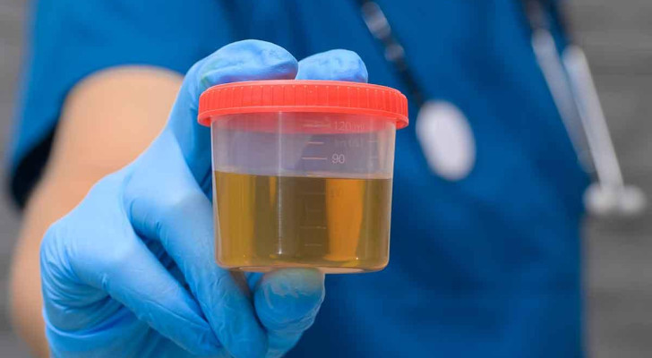 كيف تفرق بين أعراض حصوات الحالب والالتهابات البولية الشديدة؟