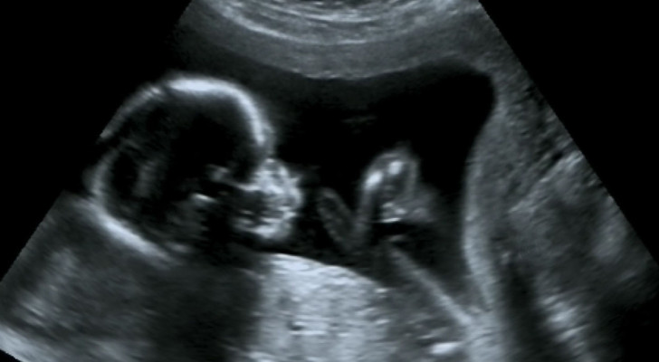كثرة تثاؤب الجنين في رحم الأم.. مؤشر قد يكشف سرا عن الطفل لاحقا