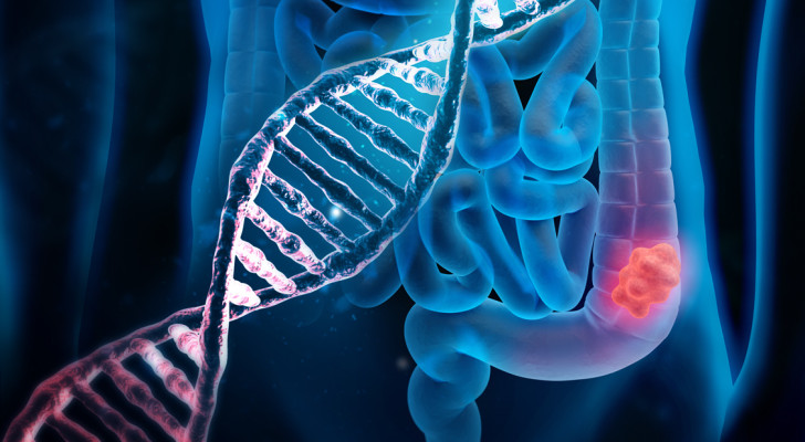 ليس تحليل الدم ولا فحص البراز.. الخبراء يكشفون أدق فحص لتشخيص سرطان القولون