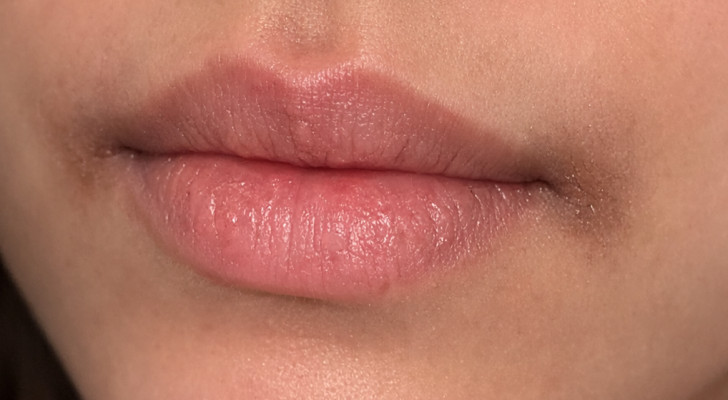 وصفة تقضي على الجفاف حول الفم وتزيل السواد