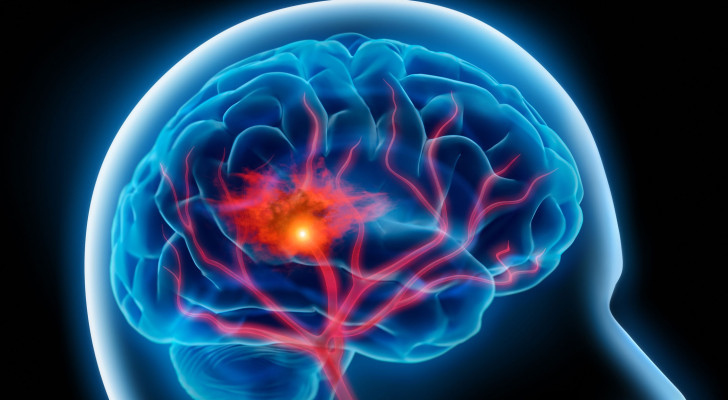 الحياة الحضرية صحية! أبحاث تثبت: العيش في المدن يقلل خطر السكتة الدماغية!